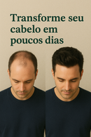 Ginger Raiz – Essência Natural para Crescimento Capilar com Gengibre | 30ml Vegano