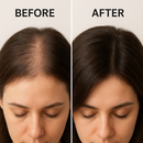 Ginger Raiz – Essência Natural para Crescimento Capilar com Gengibre | 30ml Vegano